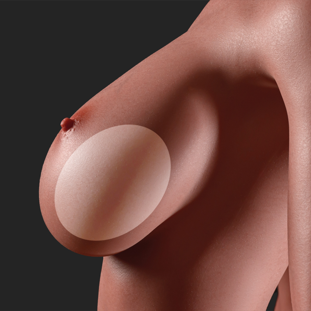 Gel breasts