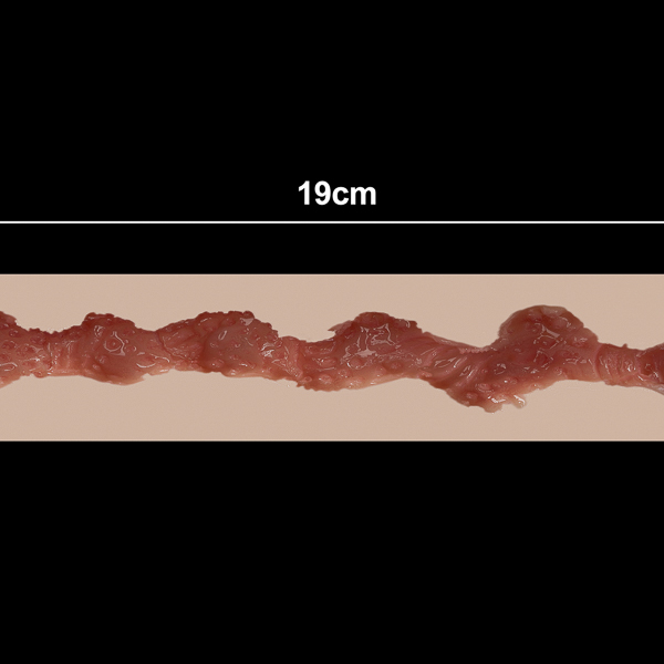 19 cm