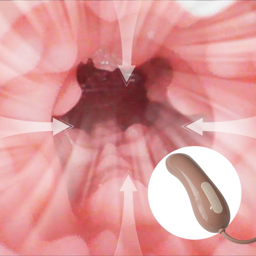 Oral suction [+$  62]