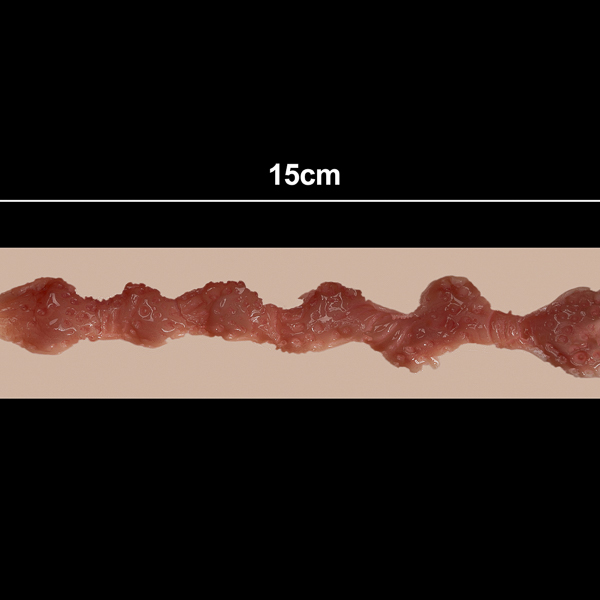 15 cm